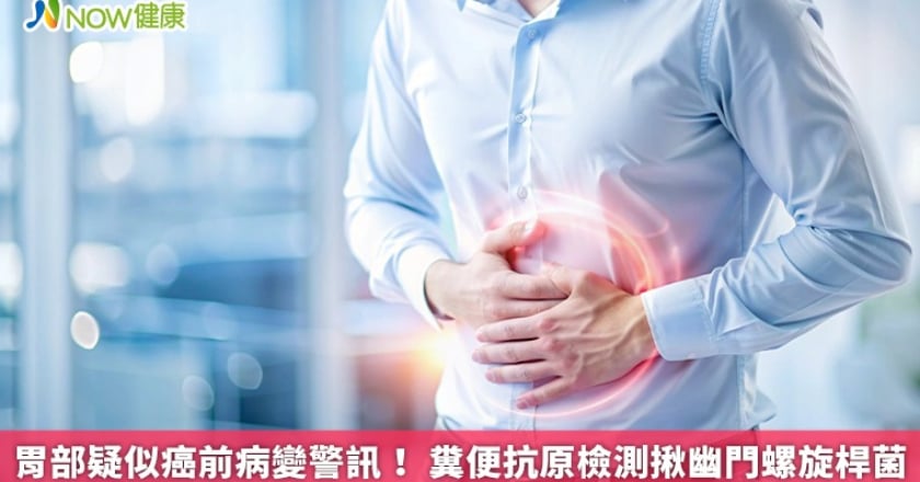 胃部疑似癌前病變警訊！ 糞便抗原檢測揪幽門螺旋桿菌