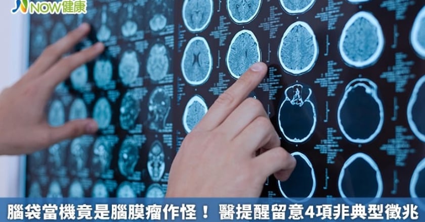 腦袋當機竟是腦膜瘤作怪! 醫提醒留意4項非典型徵兆