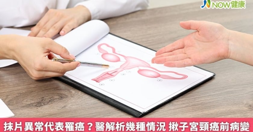 抹片異常代表罹癌？醫解析幾種情況 揪子宮頸癌前病變