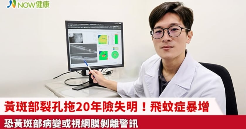 黃斑部裂孔拖20年險失明！飛蚊症暴增 恐黃斑部病變或視網膜剝離警訊