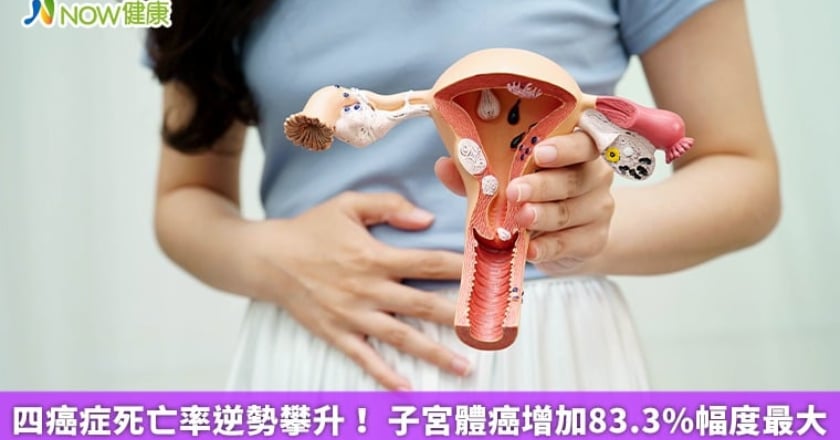 四癌症死亡率逆勢攀升! 子宮體癌增加83.3%幅度最大