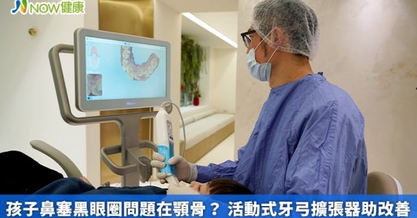 孩子鼻塞黑眼圈問題在顎骨？ 活動式牙弓擴張器助改善