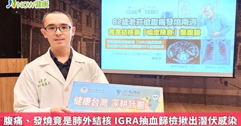 腹痛、發燒竟是肺外結核 IGRA抽血篩檢揪出潛伏感染