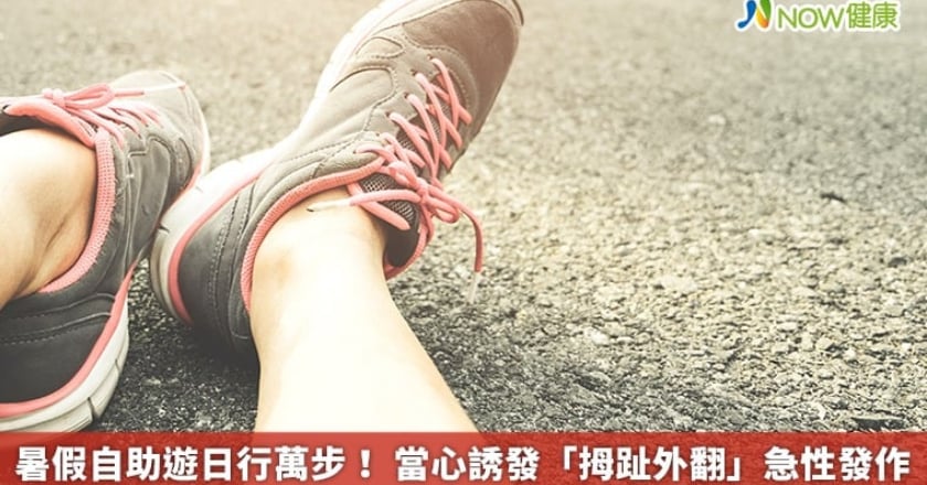 暑假自助遊日行萬步! 當心誘發「拇趾外翻」急性發作