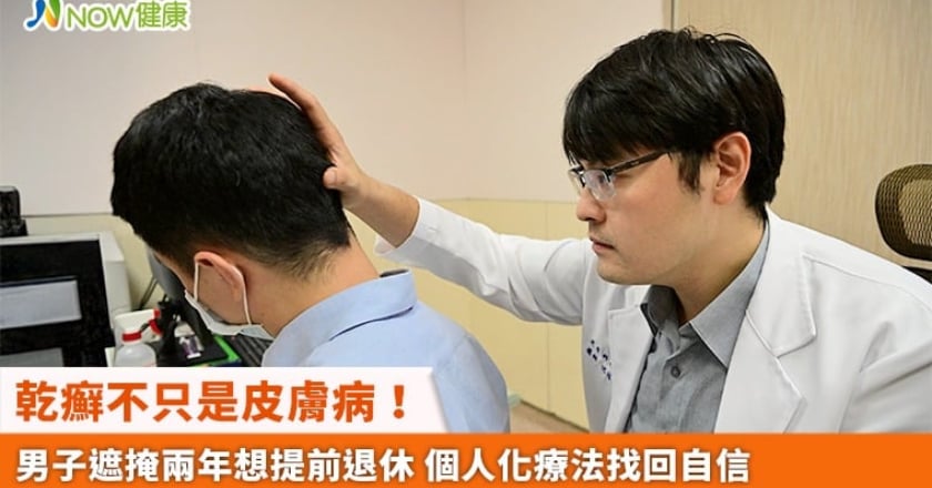 乾癬不只是皮膚病!男子遮掩兩年想提前退休 個人化療法找回自信