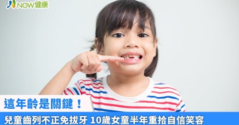 這年齡是關鍵!兒童齒列不正免拔牙 10歲女童半年重拾自信笑容