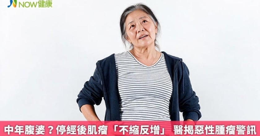 中年腹婆？停經後肌瘤「不縮反增」 醫揭惡性腫瘤警訊
