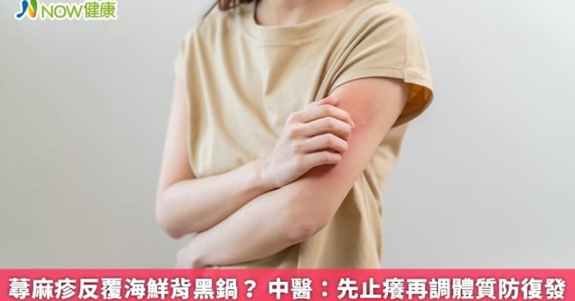 蕁麻疹反覆海鮮背黑鍋？ 中醫：先止癢再調體質防復發