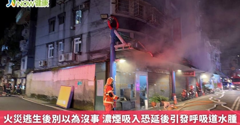火災逃生後別以為沒事 濃煙吸入恐延後引發呼吸道水腫