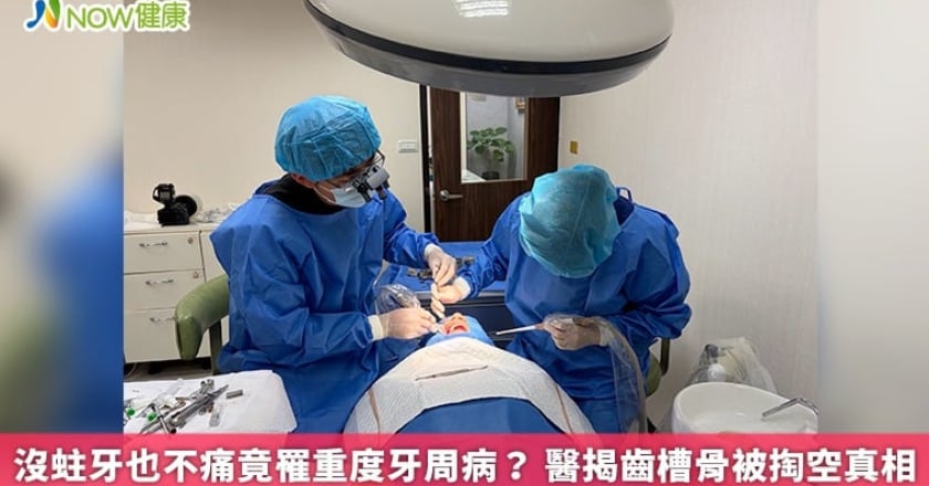 沒蛀牙也不痛竟罹重度牙周病？ 醫揭齒槽骨被掏空真相