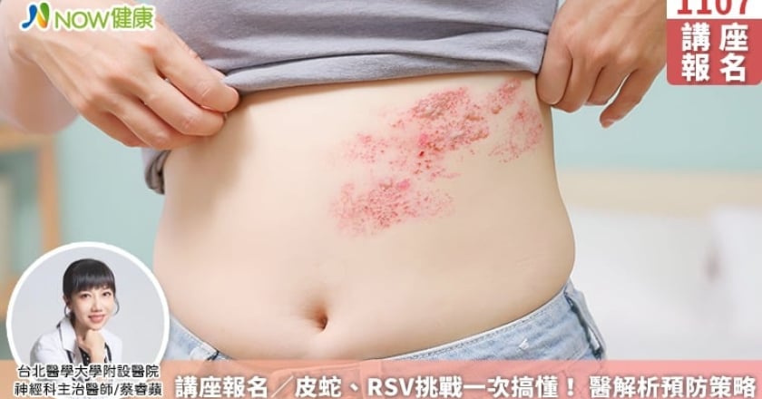 講座報名／皮蛇、RSV挑戰一次搞懂！ 醫解析預防策略