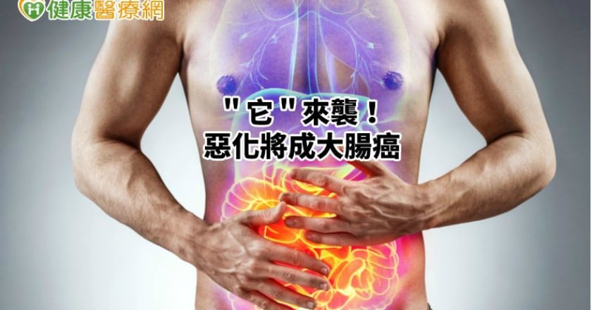 大腸激躁症來襲！惡化將成大腸癌