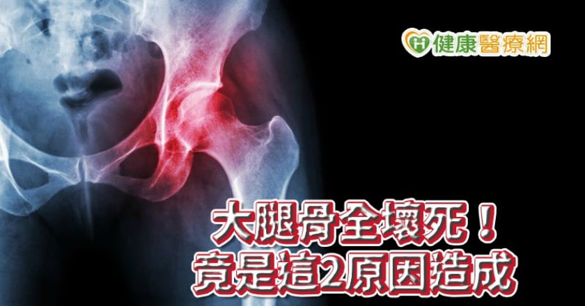 大腿骨全壞死！竟是這2原因造成　疼痛不容忽視