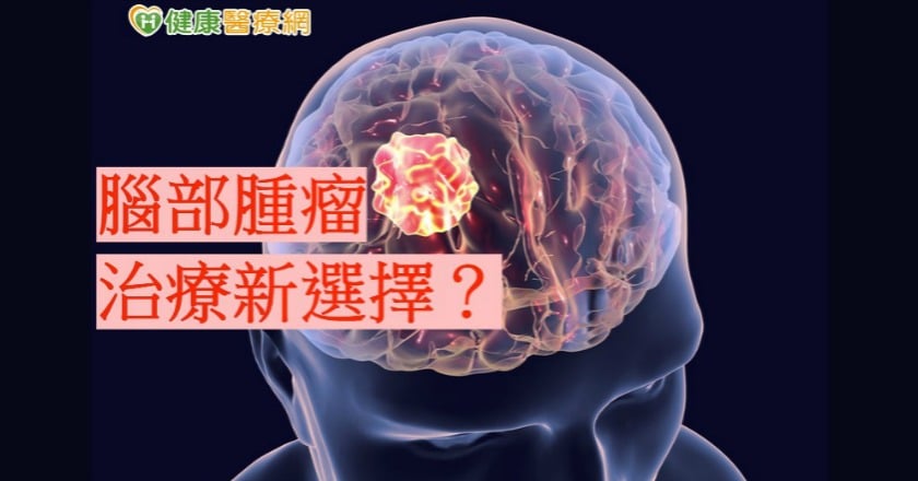 超高劑量標靶光子刀 消滅腦部腫瘤