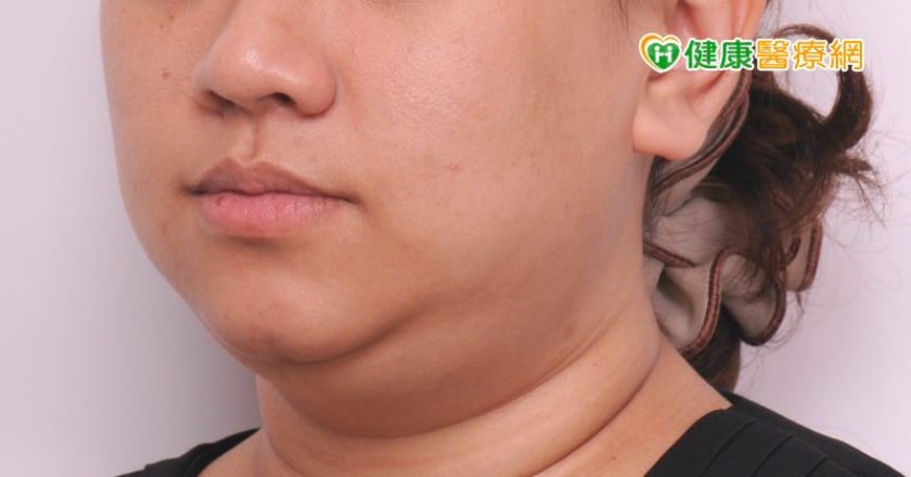 常低頭滑手機會雙下巴？　皮膚科醫師這樣說