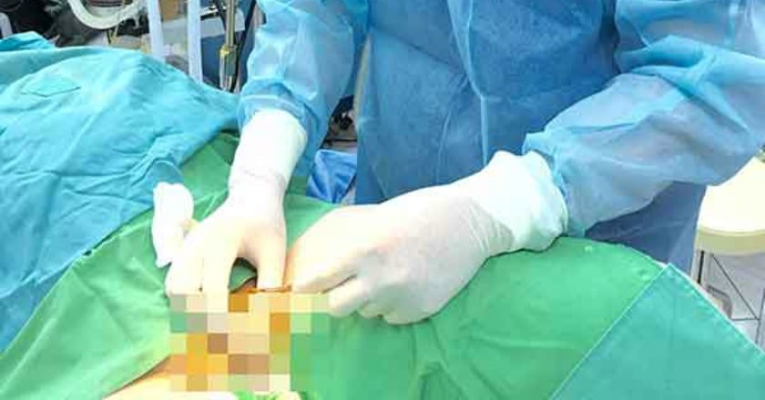 陰莖長短影響性福人生 重振雄風不能等