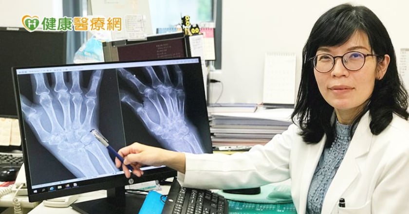 老婦莫名暴瘦　竟因類風濕性關節炎惹禍！