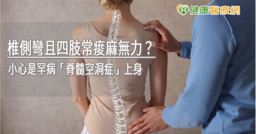 脊椎側彎且四肢常痠麻無力? 小心是罕病「脊髓空洞症」上身