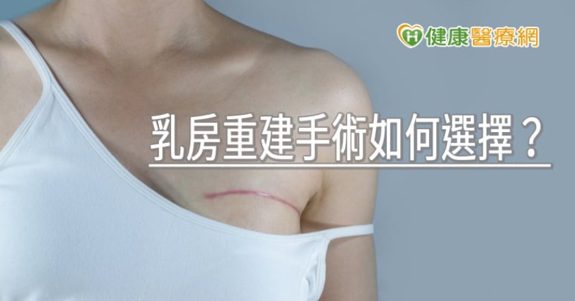 乳房重建手術如何選擇? 醫師解析現行3大方式