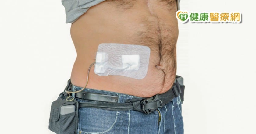 葉克膜、心室輔助器、全人工心臟怎麼分? 醫師解析心臟輔助儀器