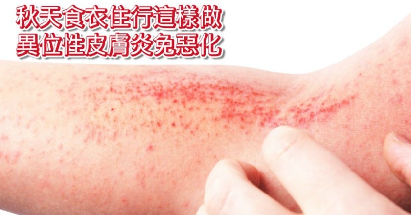 入秋忽冷忽熱　異位性皮膚炎易惡化