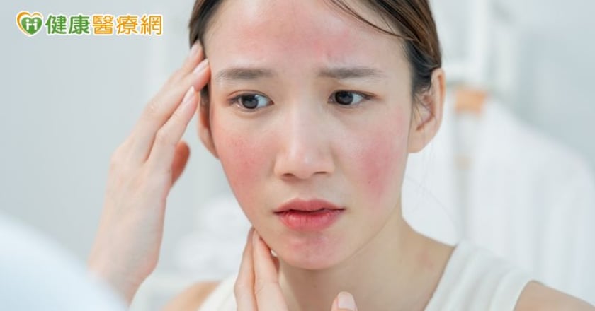 妝容不服貼還伴隨刺癢灼熱 當心是酒糟膚質在作祟