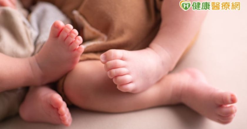 早產龍鳳雙胞胎女嬰「腹股溝疝氣」 微創手術成功修補