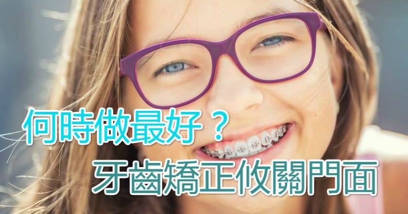 牙齒矯正攸關門面 何時做最好?