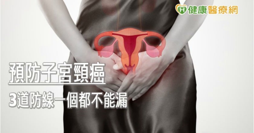子宮頸癌年增1500人！　防癌3宮略要及早做