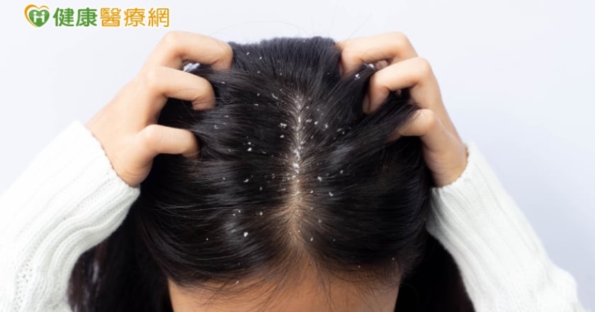 頭皮屑、頭皮油、落髮 三大頭皮問題讓人出門好尷尬