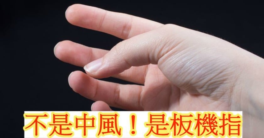 手指伸不直怎麼辦？　原來是板機指！