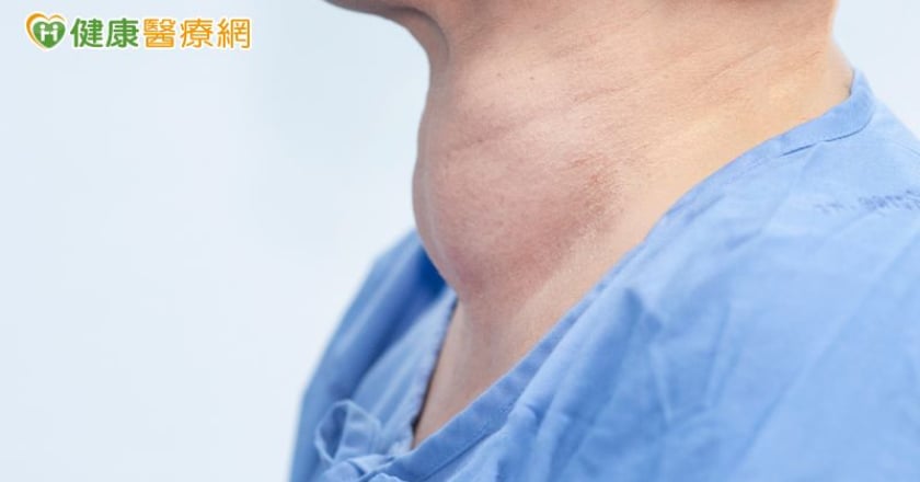 失控的甲狀腺亢進可能引發甲狀腺風暴！醫師教你如何控制甲狀腺