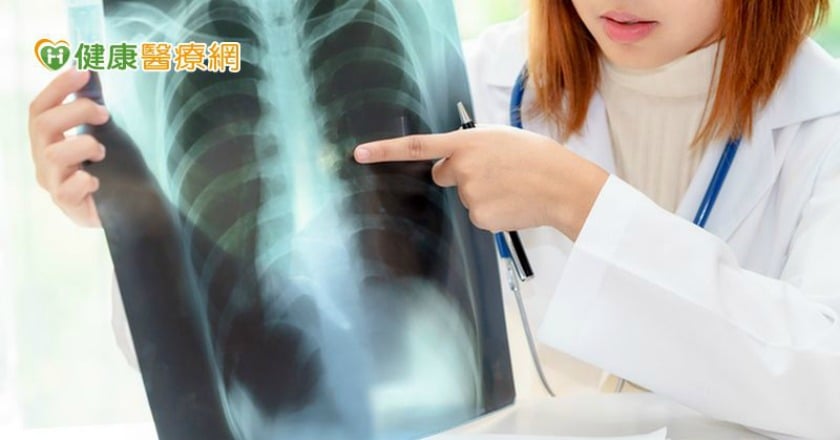 遠離肺癌上身 掌握護肺3撇步