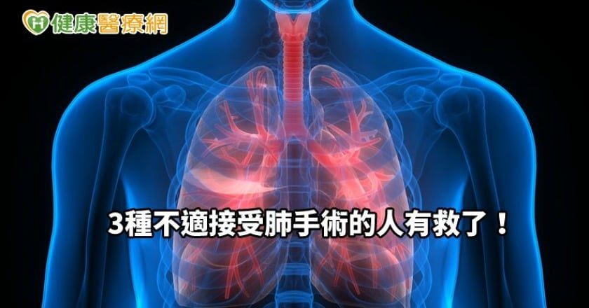用溫度凍死癌細胞! 3種不適接受肺手術的人有救了
