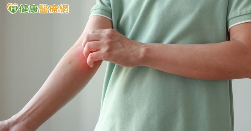 過敏族注意!醫揭「異病同治」新觀念 治療方式大改變
