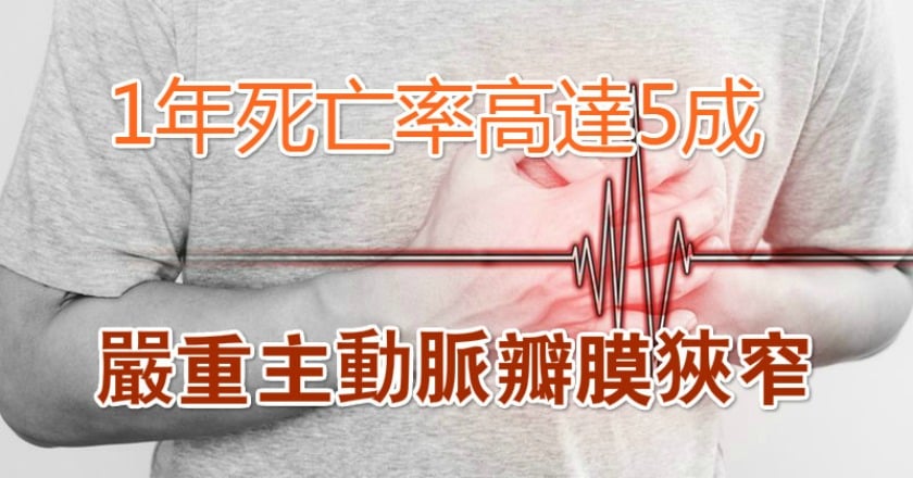 嚴重主動脈瓣膜狹窄 1年死亡率高達5成