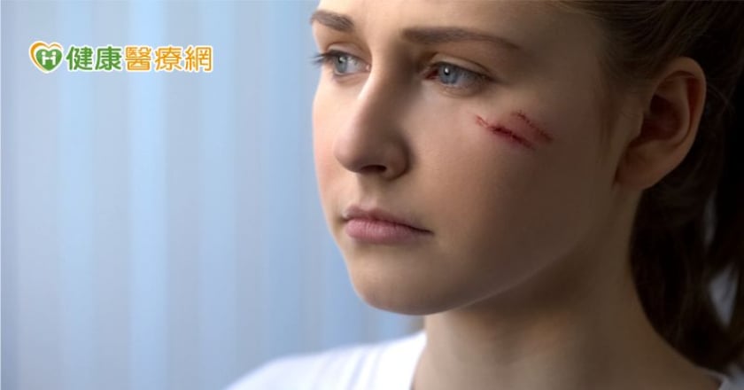 傷口久不癒合小心皮膚癌惹禍！　醫揭「常見症狀」