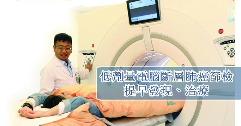 低劑量電腦斷層肺癌篩檢　協助更早發現治療