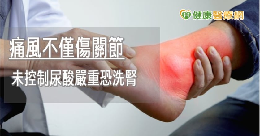 痛風不僅傷關節　未控制尿酸嚴重恐洗腎