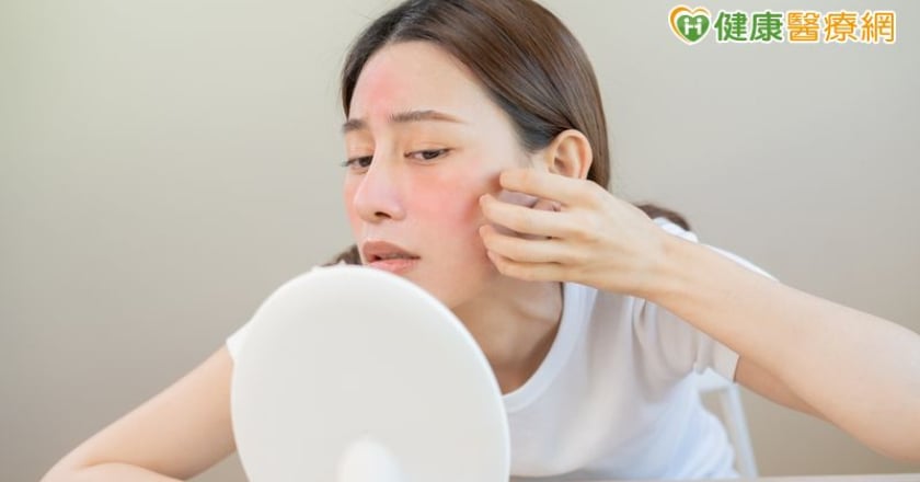 業務員為工作精緻妝容反致玫瑰斑上臉! 醫曝:這些習慣最易誘發