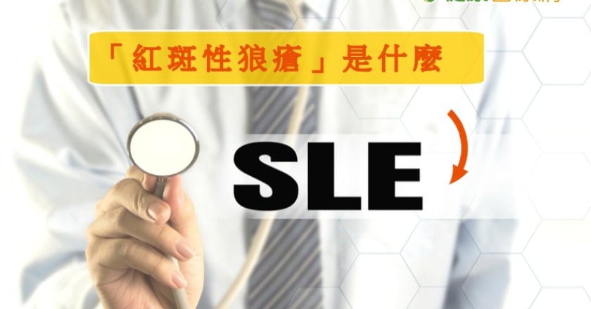 紅斑性狼瘡 影響全身不可忽視