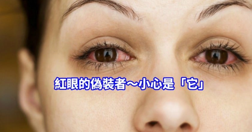 紅眼持續兩周以上 「這眼疾」恐奪走你的視力