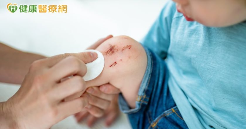 小擦傷想自己消毒殺菌 優碘、碘酒卻分不清？ 用錯可能延緩傷口復原！