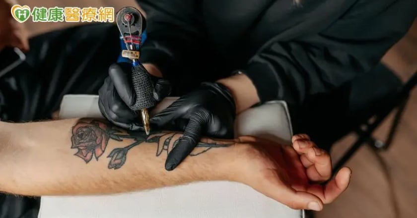 潮男刺青長滿疹子 一查竟是「刺青肉芽腫」作怪