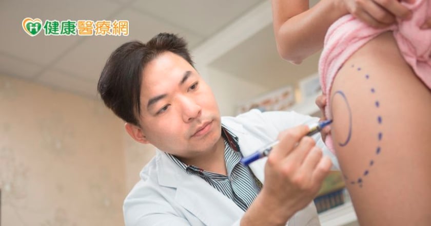 為明年春夏做好準備！　關於冬天抽脂好處你不可不知