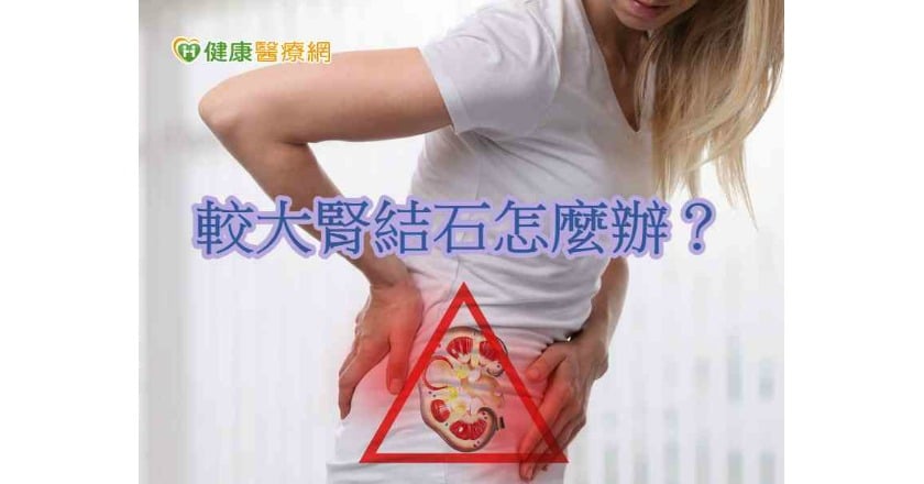 尿路結石痛得哇哇叫　微創手術一次清除