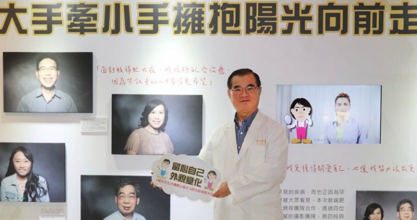 面相越老越福氣？　小心恐為腦下垂體腫瘤作祟