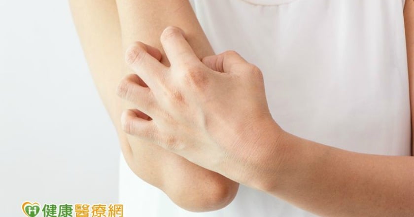 蚊咬搔癢難耐？　這些方法可有效止癢