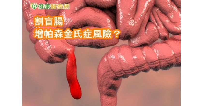 割闌尾與帕森金氏症有關？　研究：風險很小