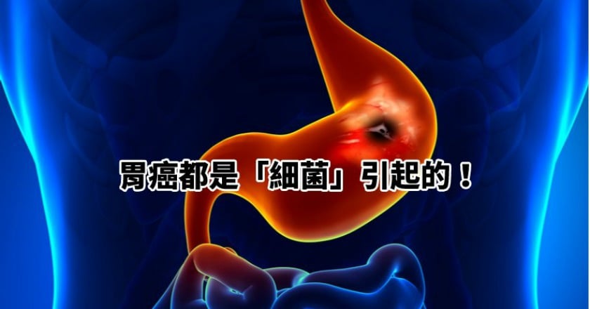 胃癌都是「細菌」引起的！　殺死它就能降低發生率